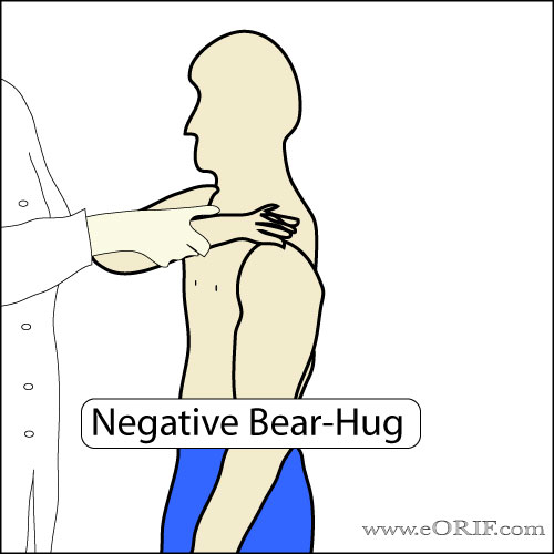 Bear Hug Test Bear Hug Test picture