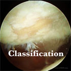 chondrmalacia patella chondromalacia patella