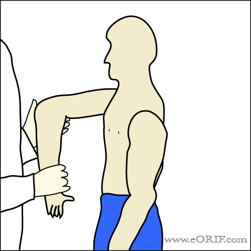 Coracoid Impingement Sign Coracoid Impingement Sign