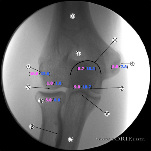 elbow ossification picture