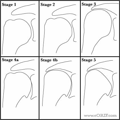 hamada classification Hamada Classification picture