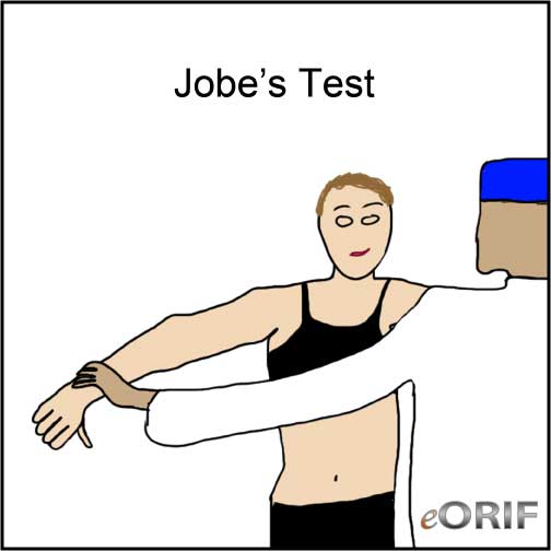 Jobe's Test Jobe's Test picture