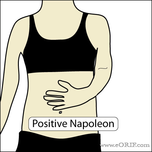 Napoleon Test Napoleon Test