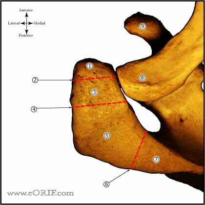 Os Acrominonale classification Os Acrominonale classification