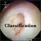 RTC tear classification RTC tear classification