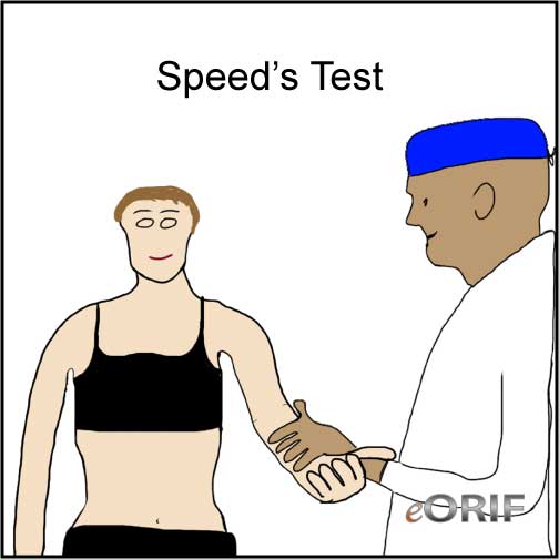 Speed's Test Speed's test