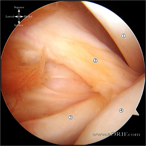 superior glenohumeral ligament superior glenohumeral ligament