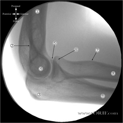 normal Lateral Elbow Xray Lateral Elbow Xray