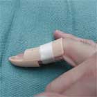 Stay Splint Stax Splint