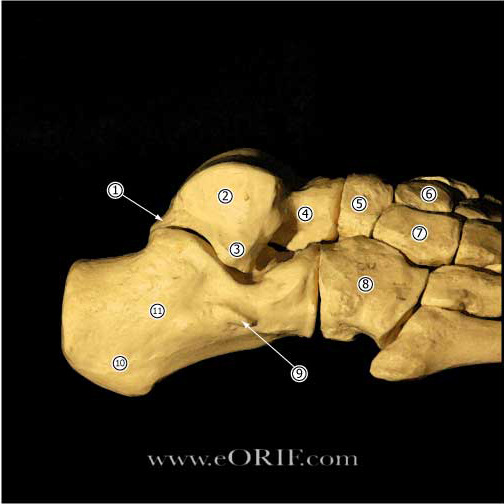 Talus lateral view image